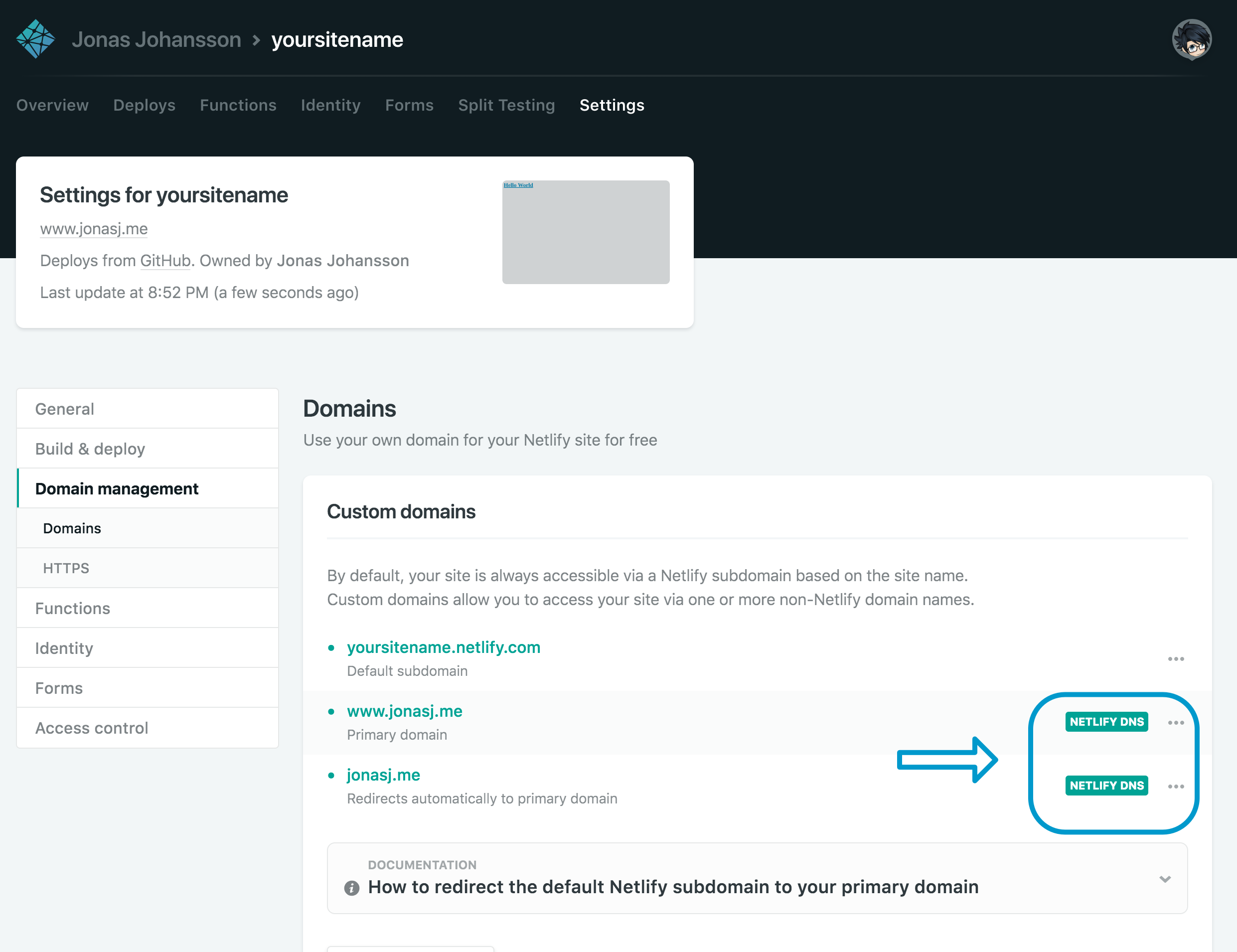 netlify dns